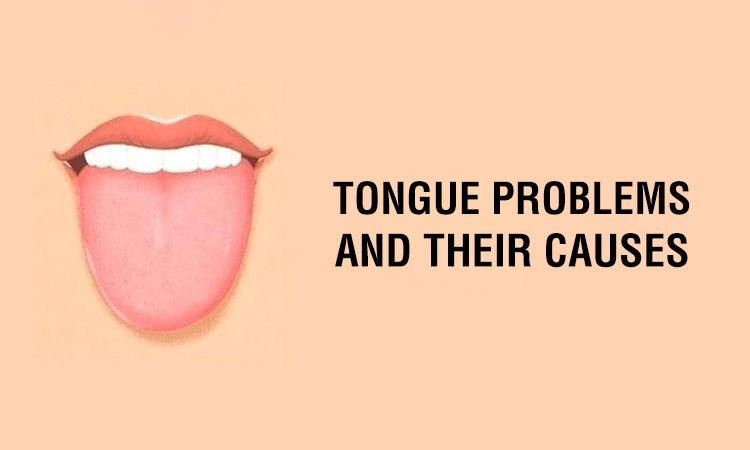 Is Your Tongue Healthy? Tongue Problems And Its Causes - HealthNews24Seven